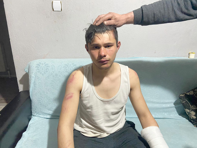 5 SAAT BOYUNCA İŞKENCE GÖRMÜŞ