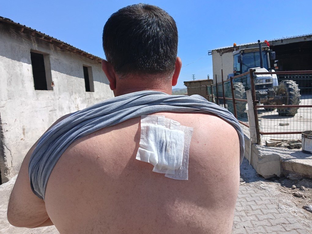 Muhtarlık Seçimi Kavgası Kanlı Bitti: 4’ü Ağır 23 Yaralı