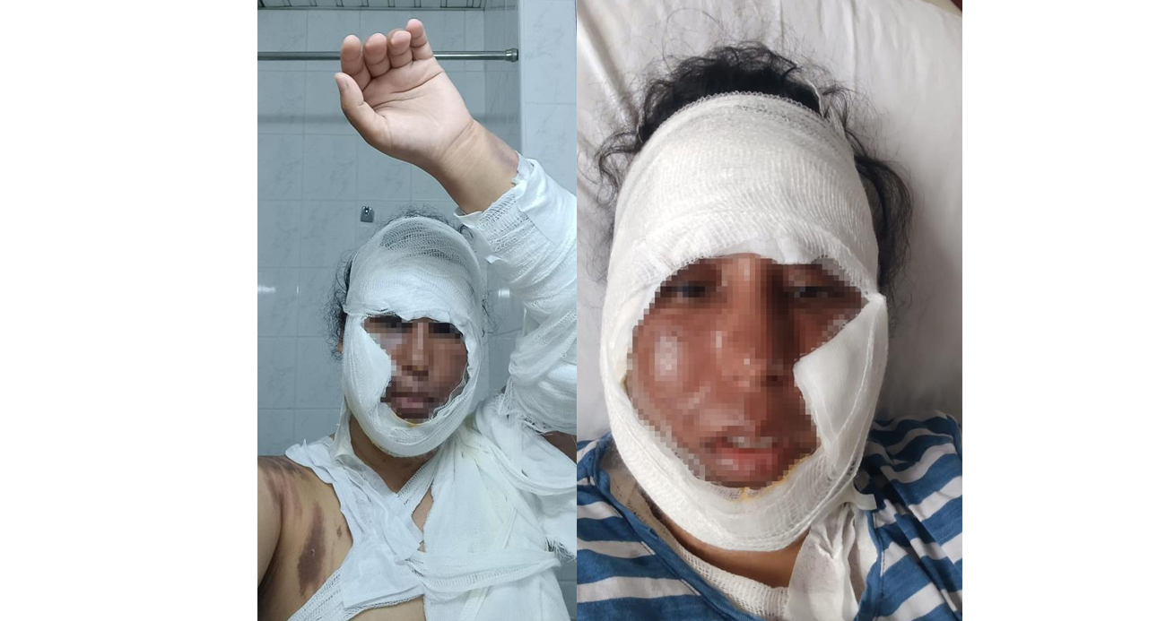 Gelin Görümce Tartışması Hastanede Son Buldu!
