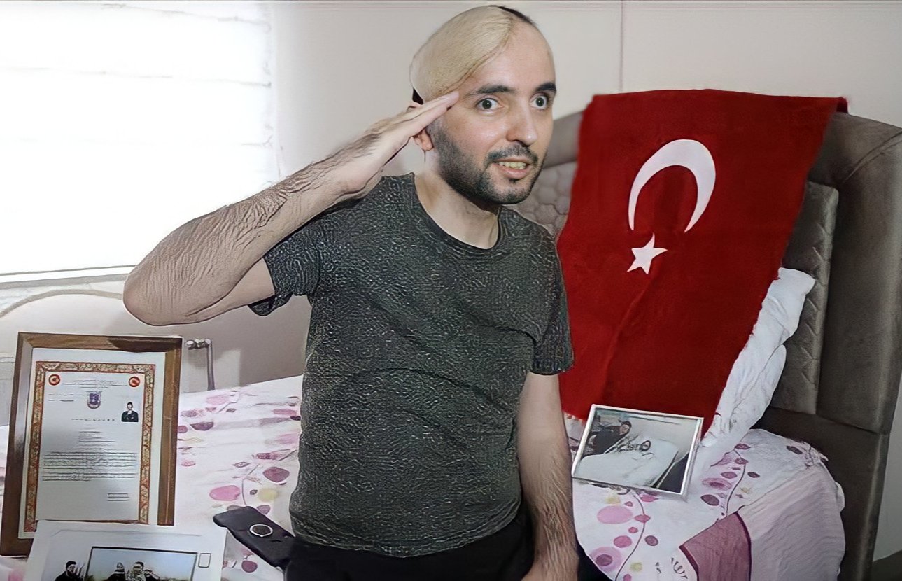 "Bin Canım Olsa, Bini de Vatana Feda Olsun" Şırnak'ta EYP Patlaması Sonucu Gazi Olan Ebubekir Durmuş'un Kahramanlık Hikayesi