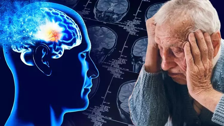 “ALZHEİMER’IN EN ERKEN BELİRTİSİ UNUTKANLIK”