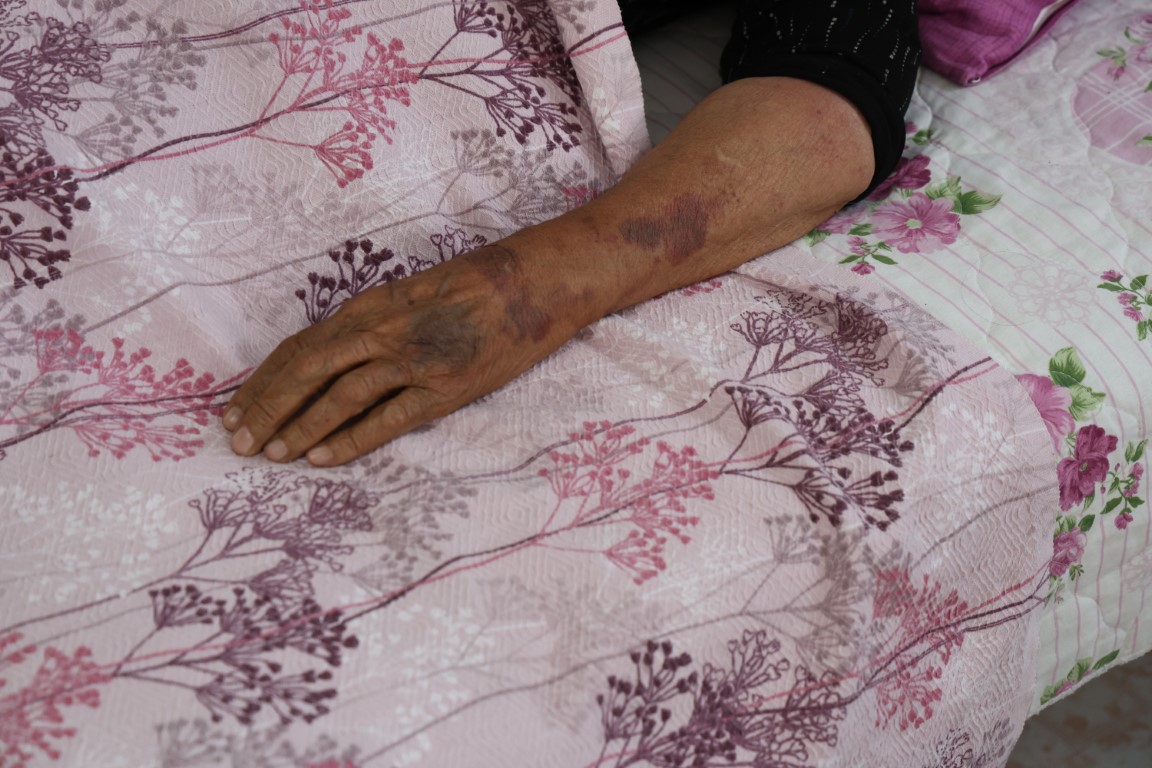 Kan Donduran Olay!  Yaşlı kadını yüzüğü için öldüresiye darbetti, mahalleli şüpheliyi hortumla dövdü