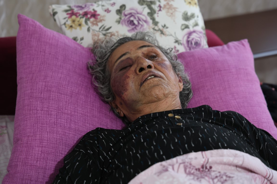 Kan Donduran Olay!  Yaşlı kadını yüzüğü için öldüresiye darbetti, mahalleli şüpheliyi hortumla dövdü