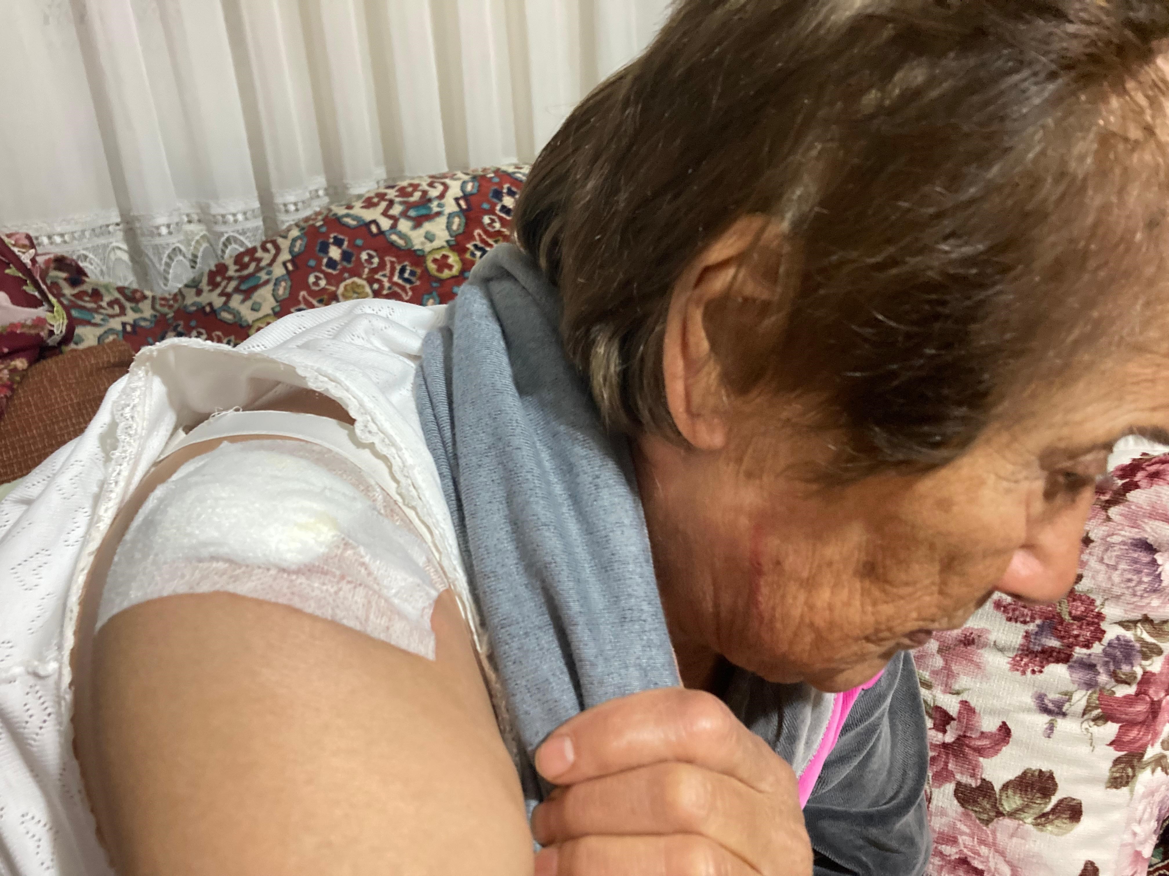 Afyonkarahisar’da Komşu Kavgası: 66 Yaşındaki Kadını Darp Etti