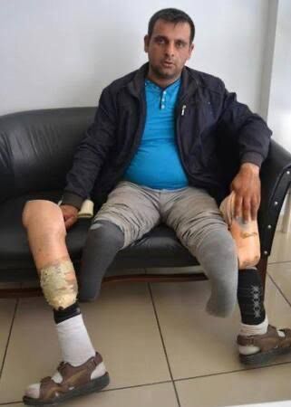 Kastamonu'dan Afyonkarahisar’a Uzanan Umut: Tuncay Yetkin, Engelli Abisi İçin Yardım Eli Bekliyor