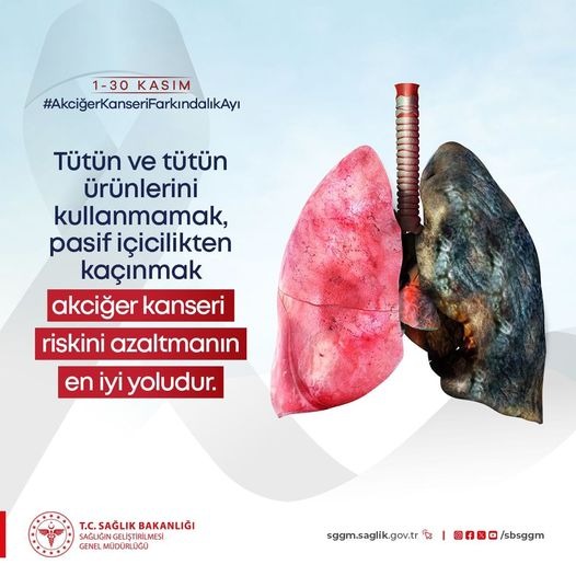 Afyonkarahisar İl Sağlık Müdürlüğü, Akciğer Kanserine Yönelik Farkındalık Mesajı Yayımladı
