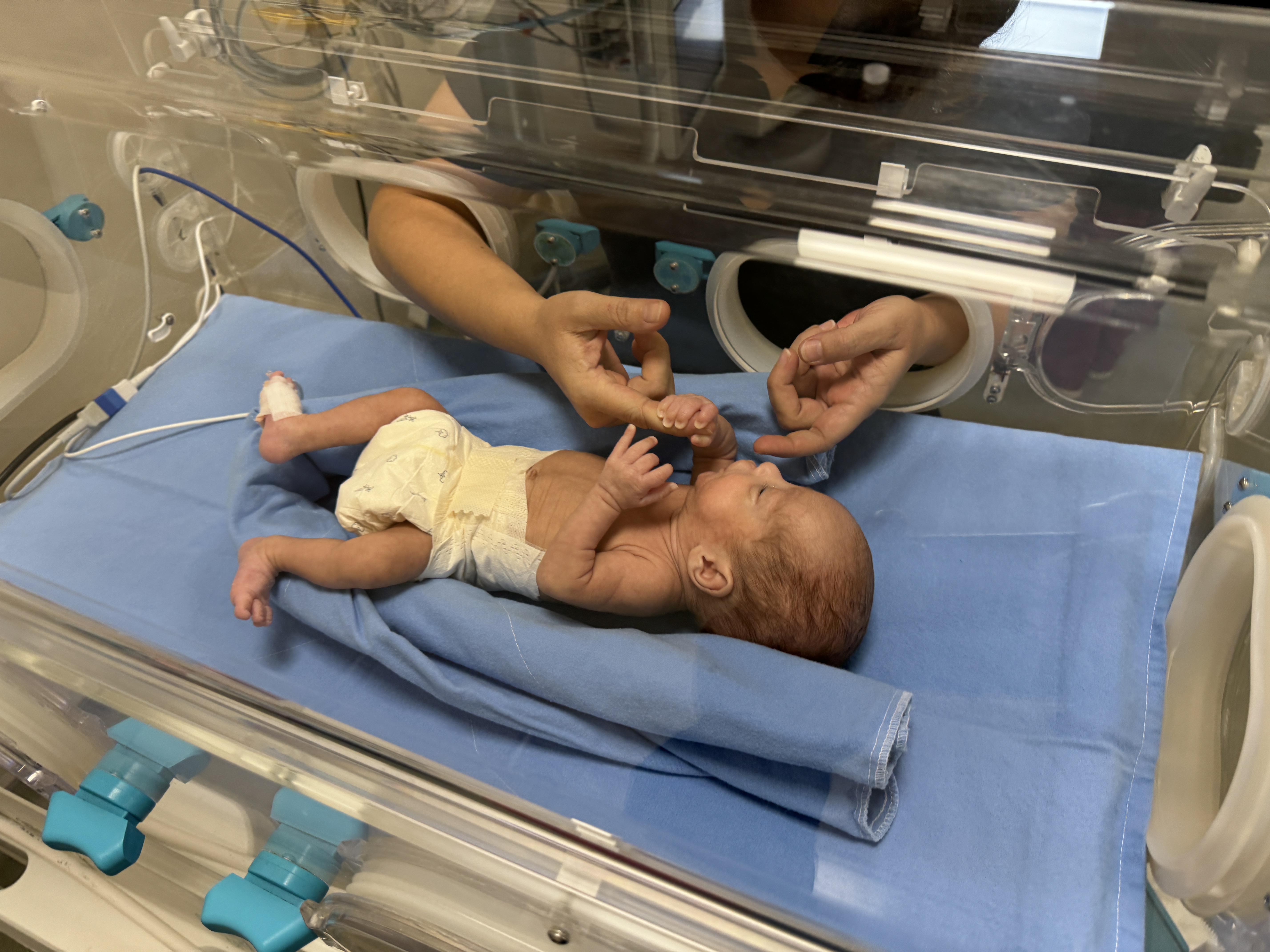Prematüre Doğan ve Entübe Edilen Umut Bebek Hayata Sarıldı