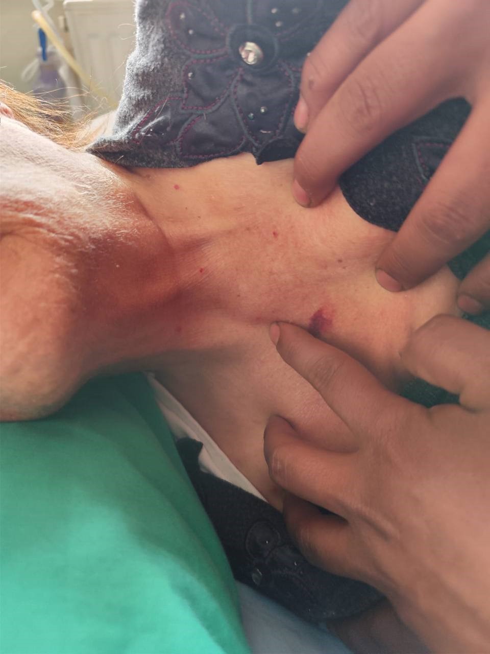 Özel Hastanenin Yoğun Bakım Ünitesinde Şiddet İddiası