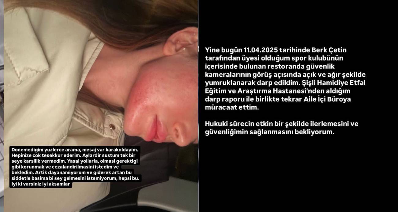 Sosyal Medya Fenomeni Danla Biliç’i Eski Sevgilisinin Darp Ettiği Anlar Kamerada