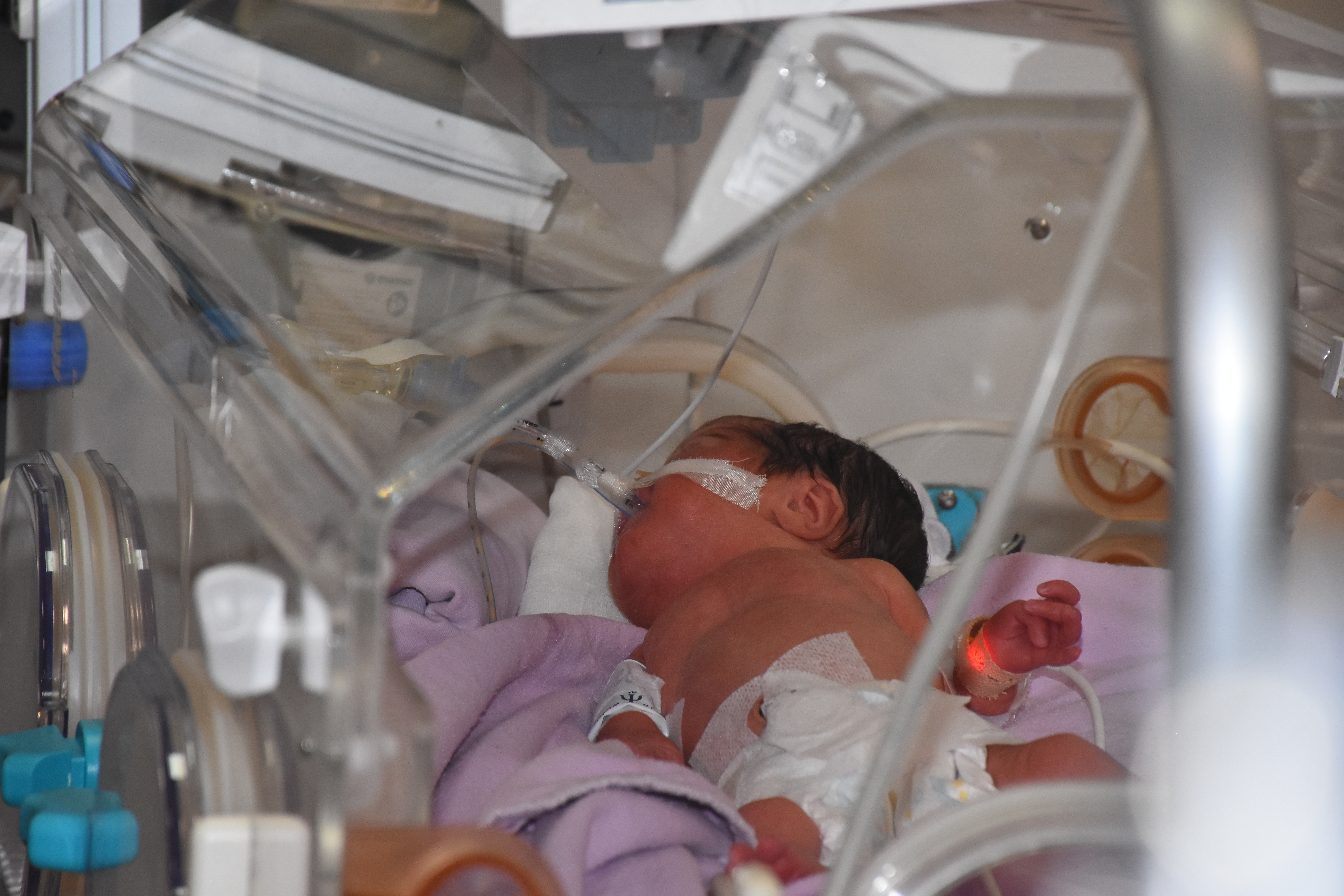 Afyonkarahisar Devlet Hastanesi Prematüre Ünitesi, Minik Hayatlara Umut Oluyor