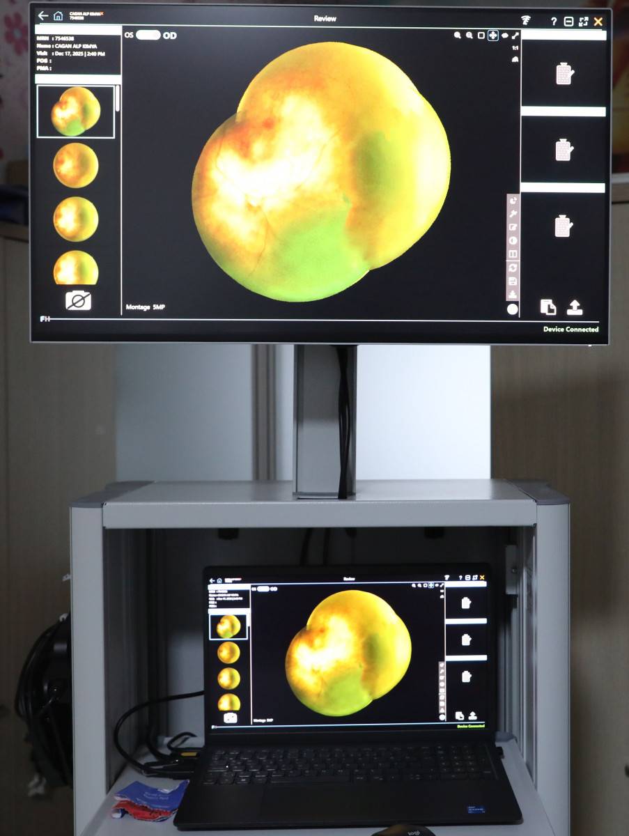 Bölgenin İlk ve Tek Dijital Göz Radarı AFSÜ’de!