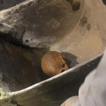 Yağış Sonrası Çöken Yolda İnsan Kafatası Ve Kemikleri Bulundu