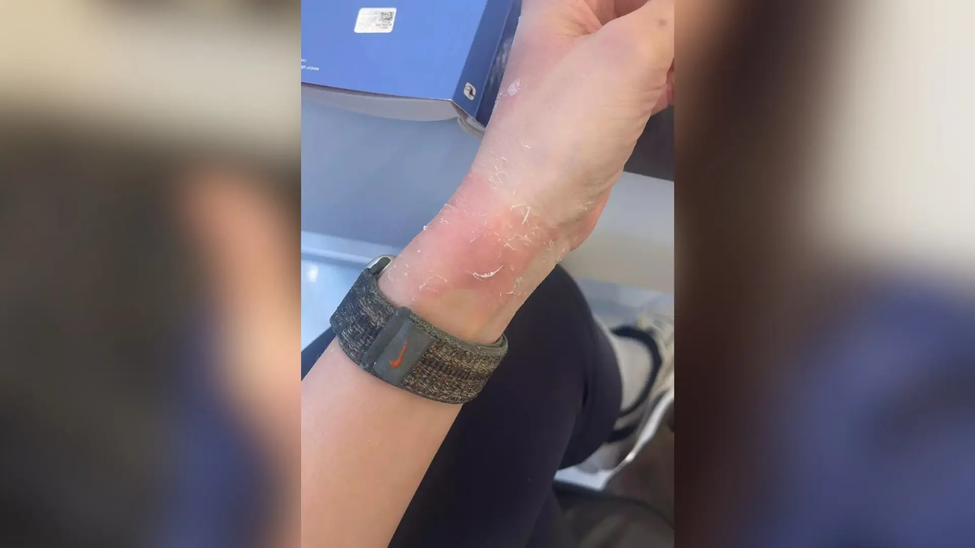 Eşref Rüya Dizi Setinde Kaza:Ceren Benderlioğlu Hastanelik Oldu!