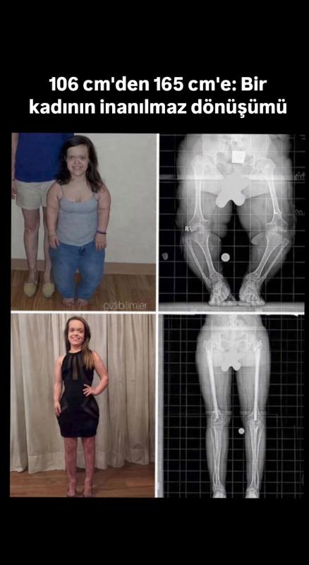 106 Santimden 1.65 Santimetreye Ulaştı