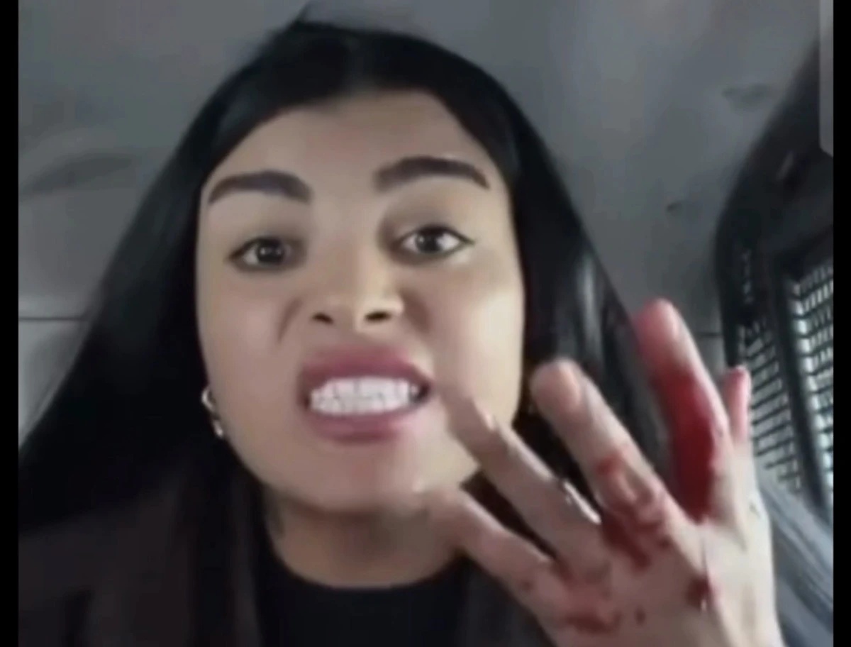 Tik Tok Fenomeni Karagül’den Dehşet: Sokak Ortasında Bıçaklı Saldırı