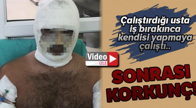 Kebapçıda fırın patladı, iş yeri sahibi ağır yaralandı: O anlar kamerada