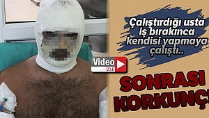 Kebapçıda fırın patladı, iş yeri sahibi ağır yaralandı: O anlar kamerada