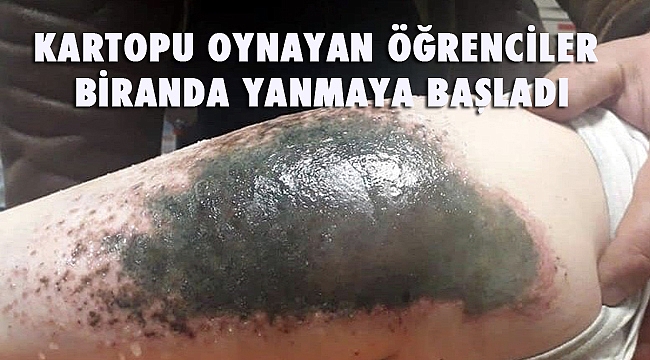 KARTOPU OYNAYAN ÖĞRENCİLER BİRANDA YANMAYA BAŞLADI