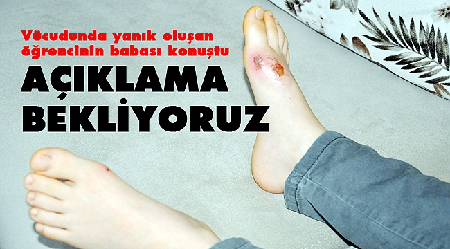 “YETKİLİLERDEN AÇIKLAMA BEKLİYORUZ”