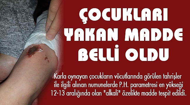 ÇOCUKLARI YAKAN MADDE BELLİ OLDU
