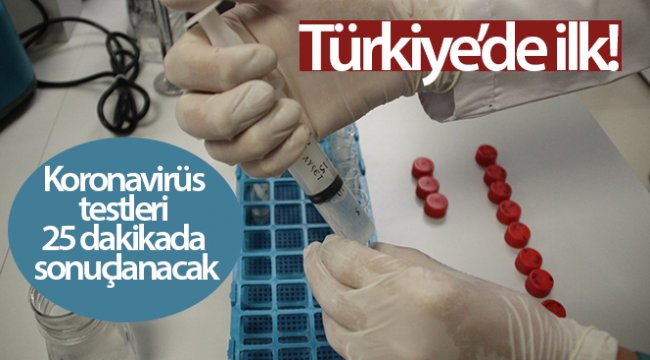 Türkiye’de ilk! Koronavirüs testleri 25 dakikada sonuçlanacak