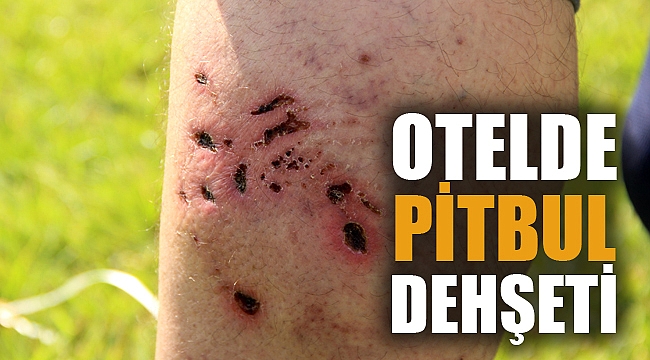 OTELDE PİTBUL DEHŞETİ