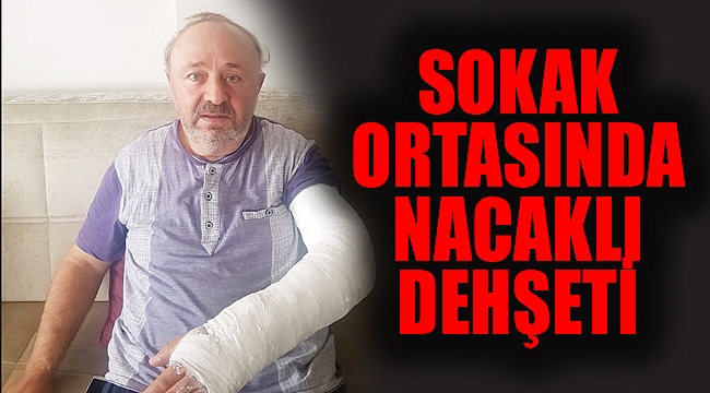 SOKAK ORTASINDA NACAKLI DEHŞETİ
