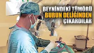 BEYİNDEKİ TÜMÖRÜ BURUN DELİĞİNDEN ÇIKARDILAR