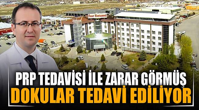 PRP tedavisi ile zarar görmüş doku tedavi edilebiliyor