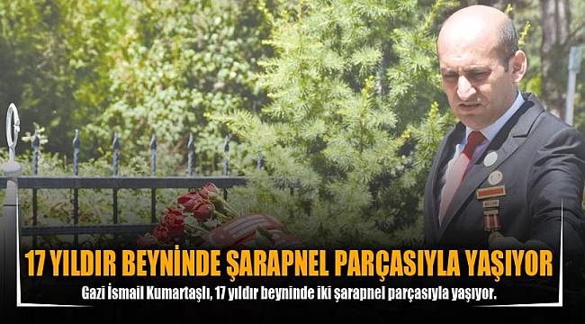 17 YILDIR BEYNİNDE ŞARAPNEL PARÇASIYLA YAŞIYOR