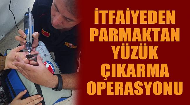 İtfaiyeden parmaktan yüzük çıkarma operasyonu