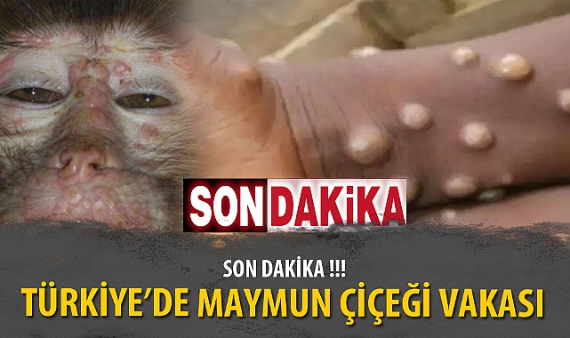 TÜRKİYE'DE MAYMUN ÇİÇEĞİ VAKASI !!!