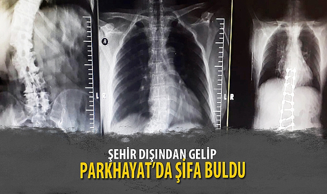 ŞEHİR DIŞINDAN GELİP PARKHAYAT’DA ŞİFA BULDU