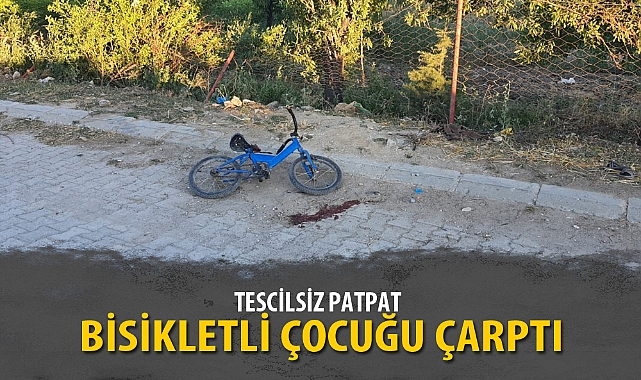 TESCİLSİZ PATPAT BİSİKLETLİ ÇOCUĞU ÇARPTI