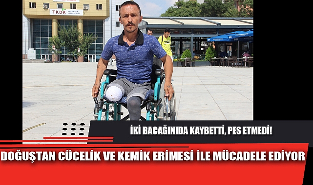İKİ BACAĞINIDA KAYBETTİ, PES ETMEDİ!