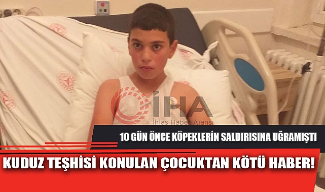 KUDUZ TEŞHİSİ KONULAN ÇOCUKTAN KÖTÜ HABER!
