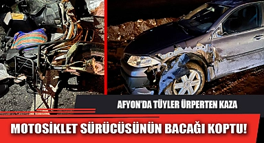 MOTOSİKLET SÜRÜCÜSÜNÜN BACAĞI KOPTU!