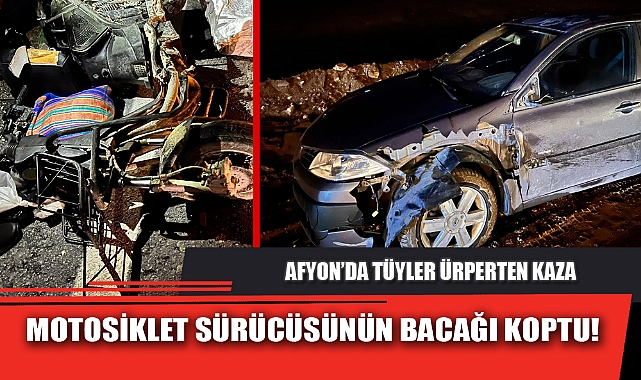 MOTOSİKLET SÜRÜCÜSÜNÜN BACAĞI KOPTU!