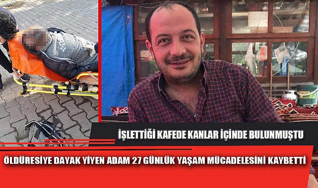 ÖLDÜRESİYE DAYAK YİYEN ADAM 27 GÜNLÜK YAŞAM MÜCADELESİNİ KAYBETTİ