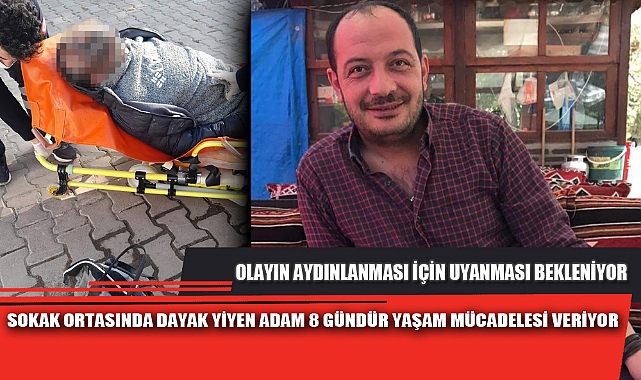 SOKAK ORTASINDA DAYAK YİYEN ADAM 8 GÜNDÜR YAŞAM MÜCADELESİ VERİYOR