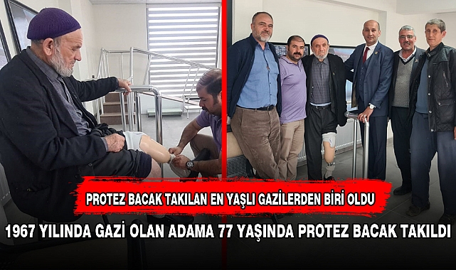 1967 YILINDA GAZİ OLAN ADAMA 77 YAŞINDA PROTEZ BACAK TAKILDI