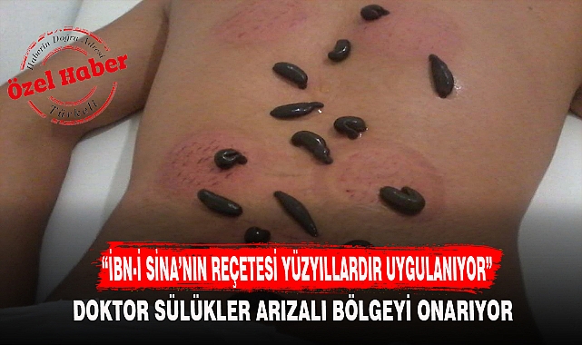 "İBN-İ SİNA'NIN REÇETESİ YÜZYILLARDIR UYGULANIYOR"