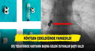 DİŞ TEDAVİSİNDE HASTANIN BAŞINA GELENİ DUYANLAR ŞAŞTI KALDI
