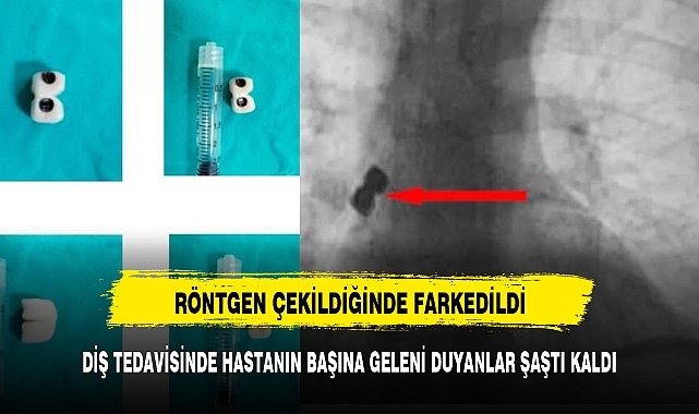 DİŞ TEDAVİSİNDE HASTANIN BAŞINA GELENİ DUYANLAR ŞAŞTI KALDI