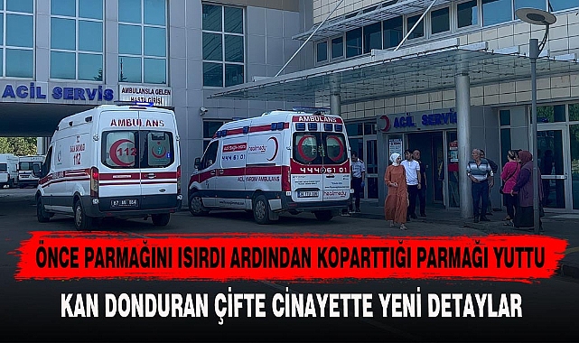 ÖNCE PARMAĞINI ISIRDI ARDINDAN KOPARTTIĞI PARMAĞI YUTTU