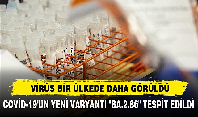 VİRÜS BİR ÜLKEDE DAHA GÖRÜLDÜ