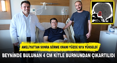 BEYNİNDE BULUNAN 4 CM KİTLE BURNUNDAN ÇIKARTILIDI