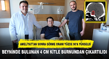 BEYNİNDE BULUNAN 4 CM KİTLE BURNUNDAN ÇIKARTILIDI