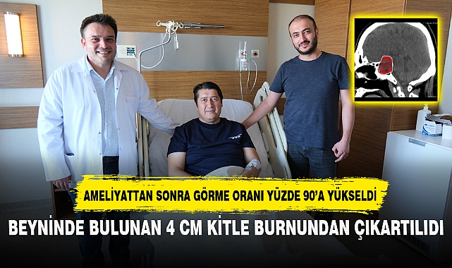 BEYNİNDE BULUNAN 4 CM KİTLE BURNUNDAN ÇIKARTILIDI