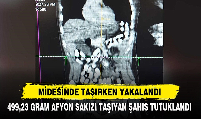 MİDESİNDE TAŞIRKEN YAKALANDI